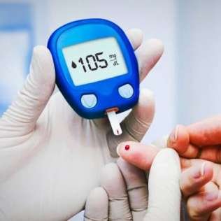 شرائط كونتور